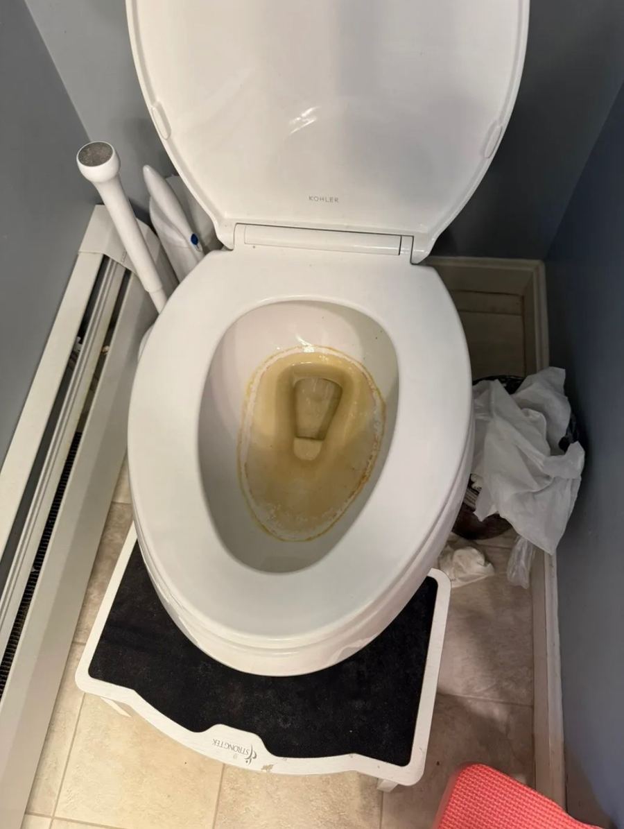 Heavily stained toilet bowl before deep cleaning